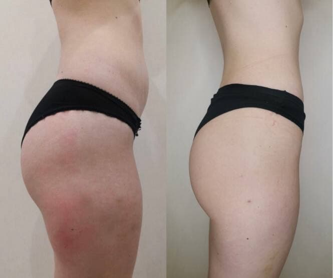 Результат учасниці — до і після 2